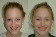 Click to view before & after treatment