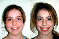 Click to view before & after treatment