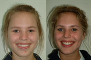 Click to view before & after treatment